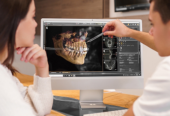 Швейцарське планування